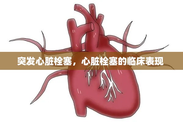 突发心脏栓塞,心脏栓塞的临床表现